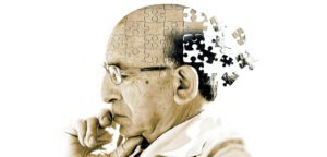 Morbo di Alzheimer