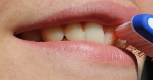 denti ingialliti rimedi naturali