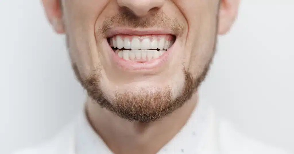 bruxismo negli uomini