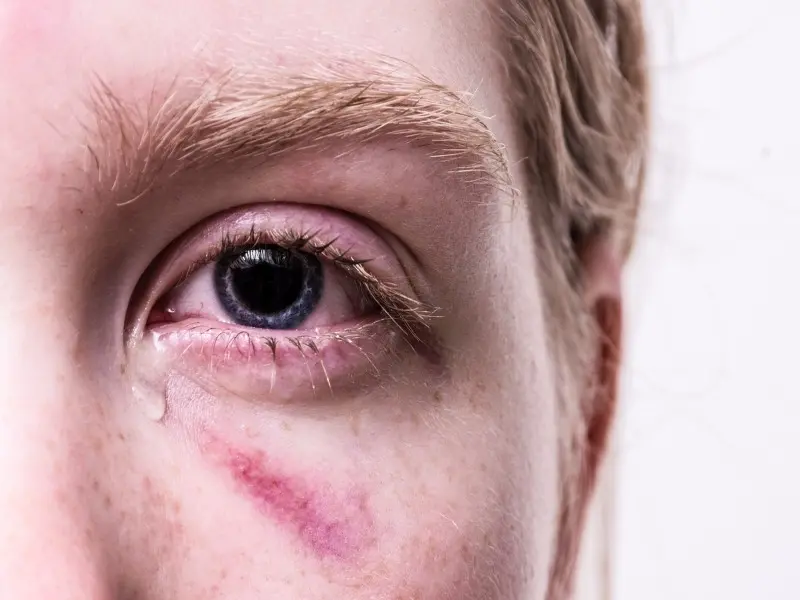 Nonostante i passi avanti e le rivendicazioni femministe, gli episodi di violenze sulle donne e sessismo continuano a verificarsi in ogni parte del mondo.
