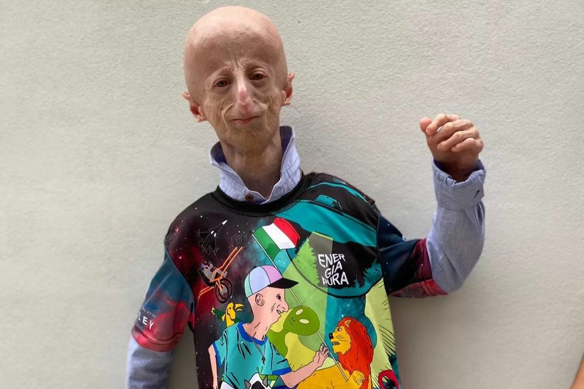 Il nostro addio a Sammy Basso, un grande uomo a dispetto della progeria.