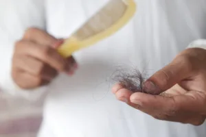 Trattamenti anticaduta capelli uomo